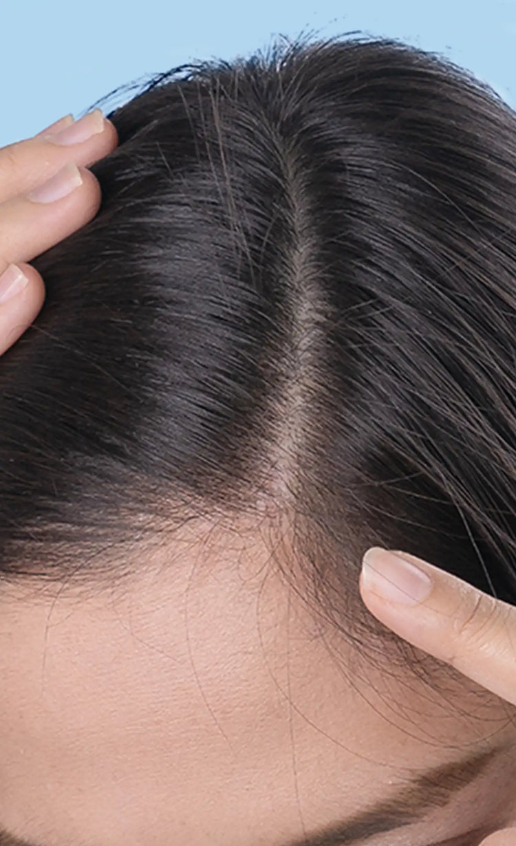 Soothed<br>scalp