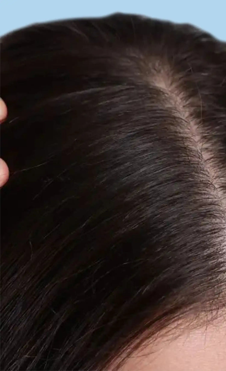 Stimulates dormant hair follicles