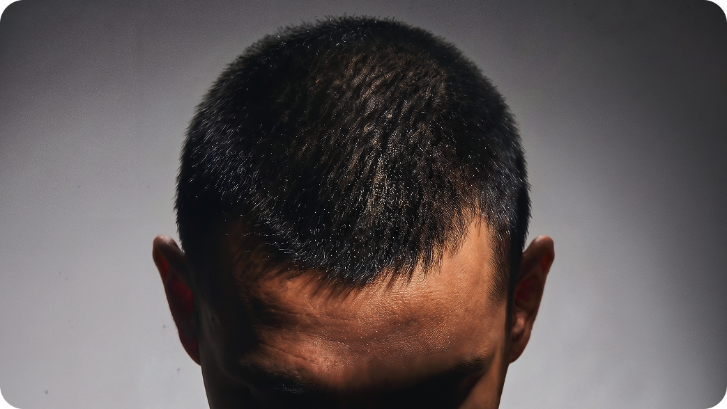 Close-up of scalp