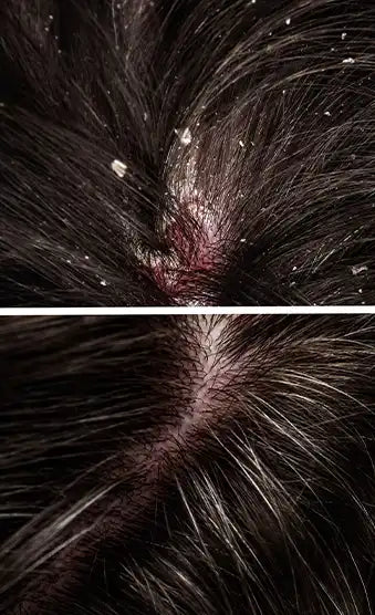  Sustained<br>anti-fungal action