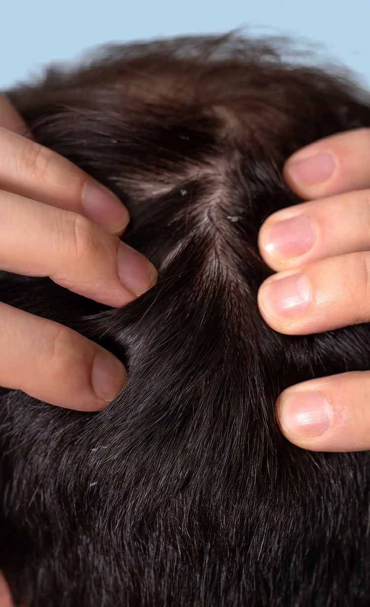 Visibly<br>less dandruff