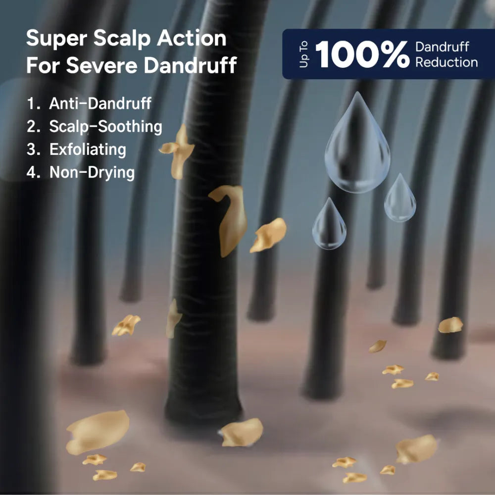 anti-dandruff-shampoo-and-tonic Secondary