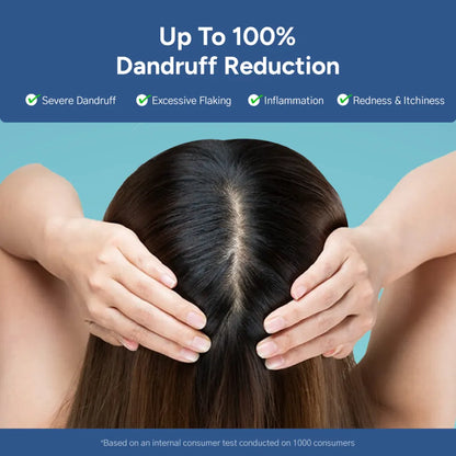 anti-dandruff-shampoo-and-tonic Secondary