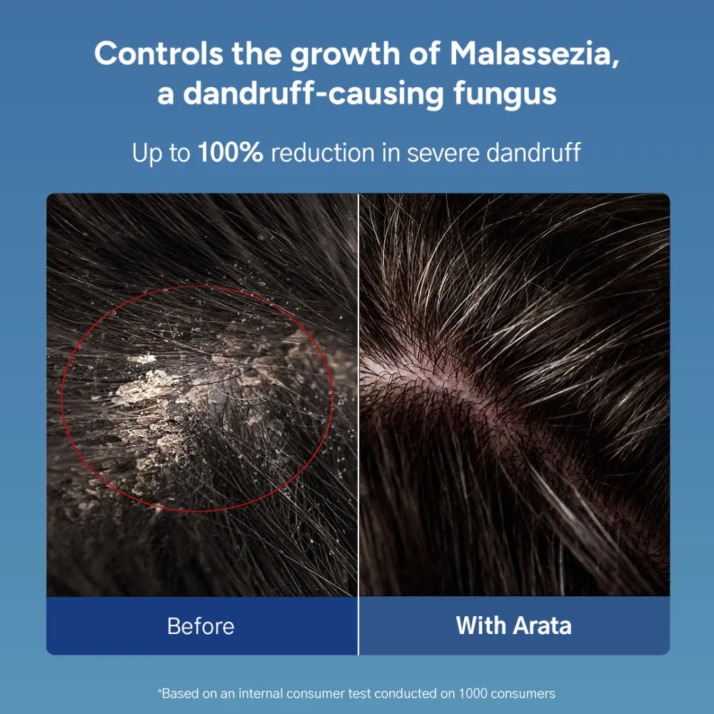 anti-dandruff-shampoo-and-tonic Secondary