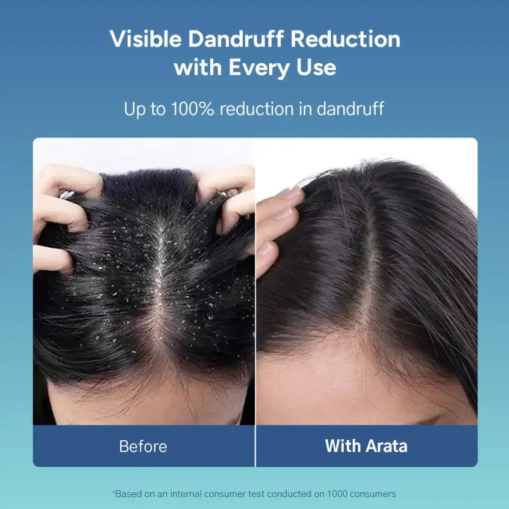 Anti_Dandruff_Shampoo_Conditioner Secondary