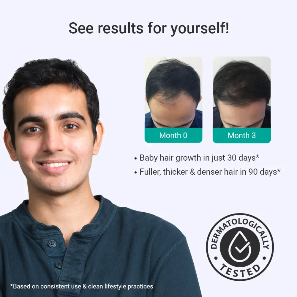 Intensive Hair Growth Serum | Derma Roller (FREE)