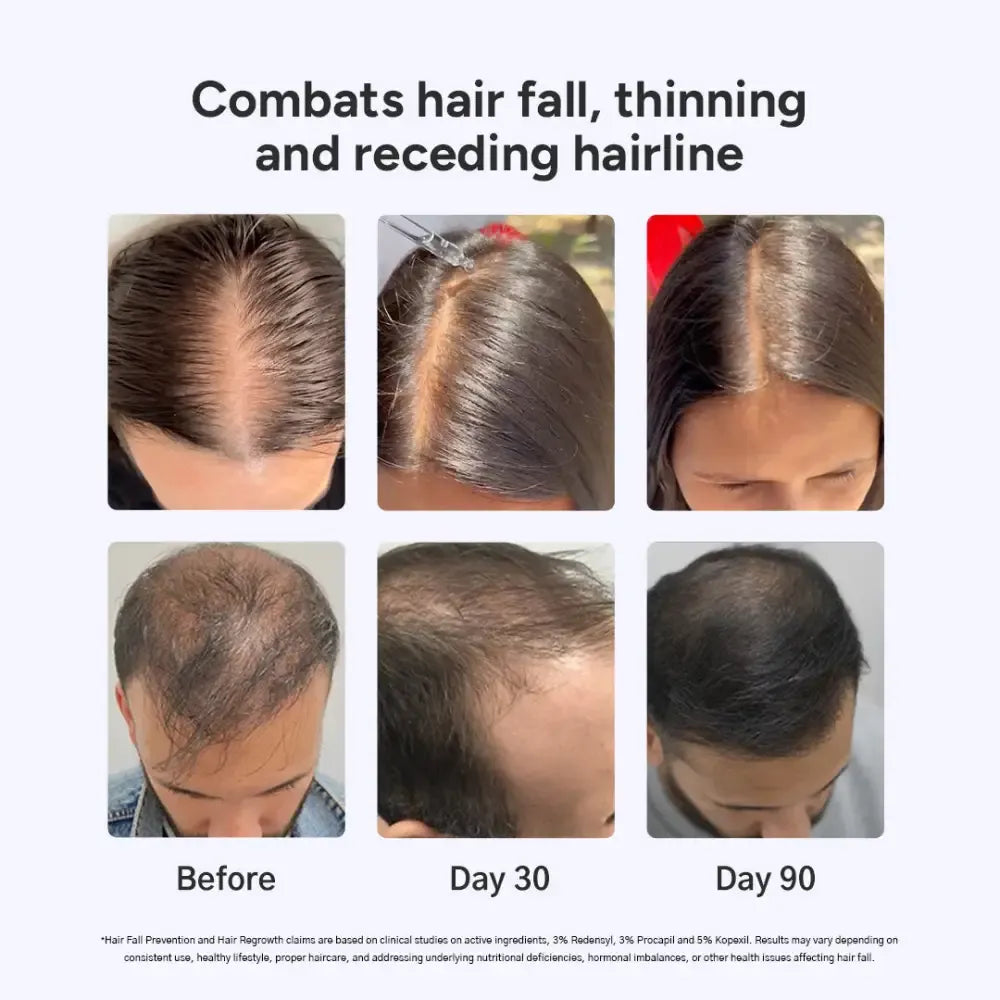 intensive-hair-growth-serum-for-men-women-pack-of-2-derma