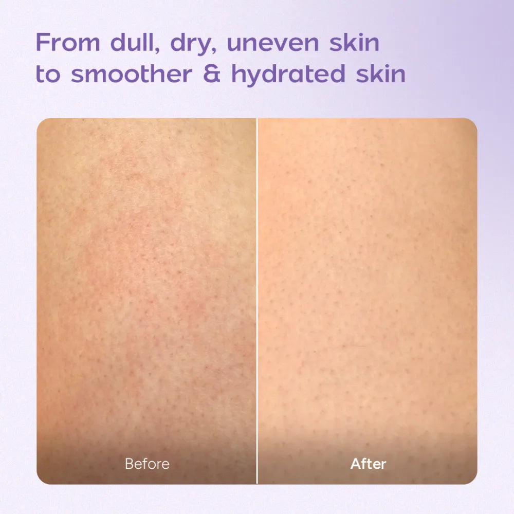 Niacinamide Body Milk for Dull and Dehydrated Skin | Lightweight and Fast-Absorbing | Provides Hydration | 200 ml