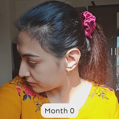 Intensive hair growth serum video